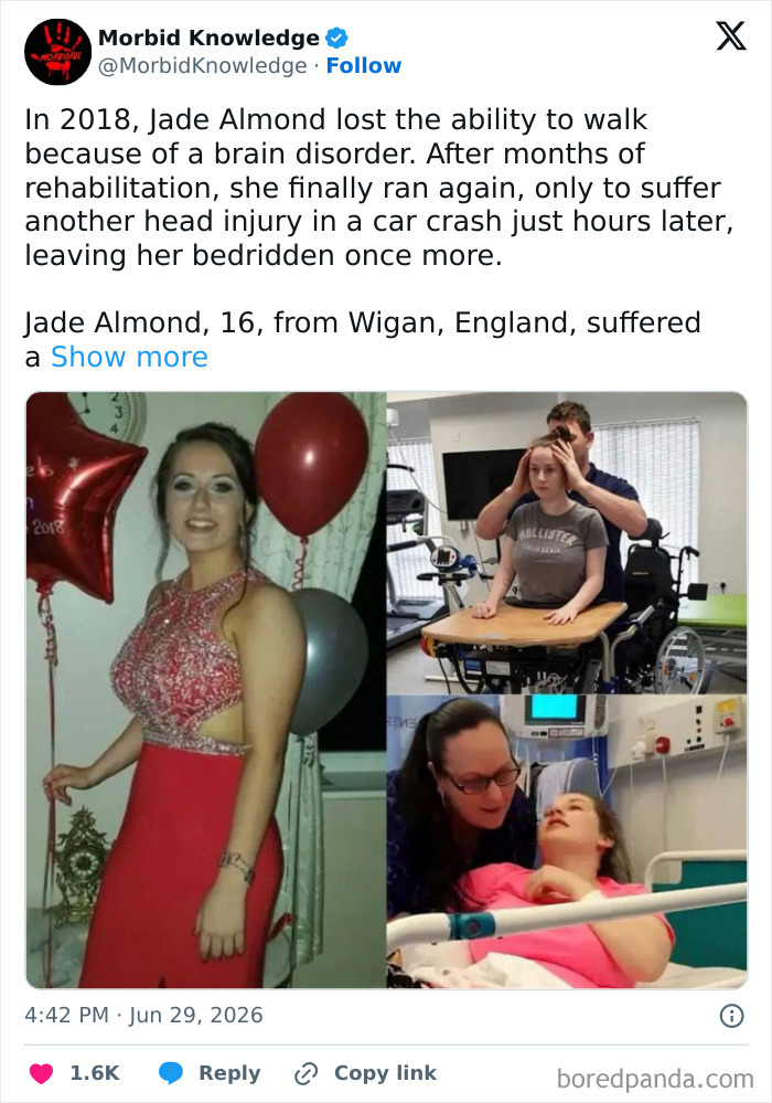 A young woman in a red dress and then in a hospital bed, showing a sad story of a brain disorder.