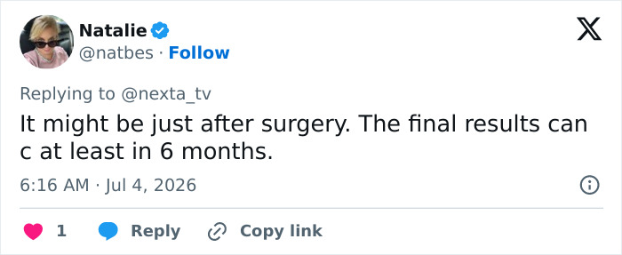 Woman’s Post-Plastic Surgery Photos Divide The Internet As She And Her Surgeon Celebrate The Results