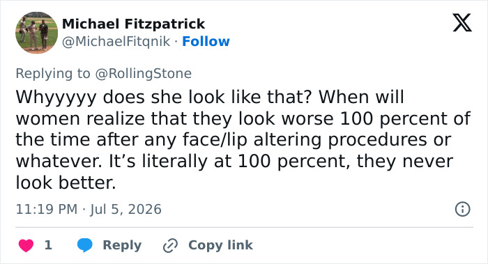 A tweet by Michael Fitzpatrick questioning Adele's appearance, linking it to plastic surgery. A plastic surgeon discusses Adele's appearance. A tweet by Michael Fitzpatrick questioning Adele's appearance, linking it to plastic surgery. A plastic surgeon discusses Adele's appearance.