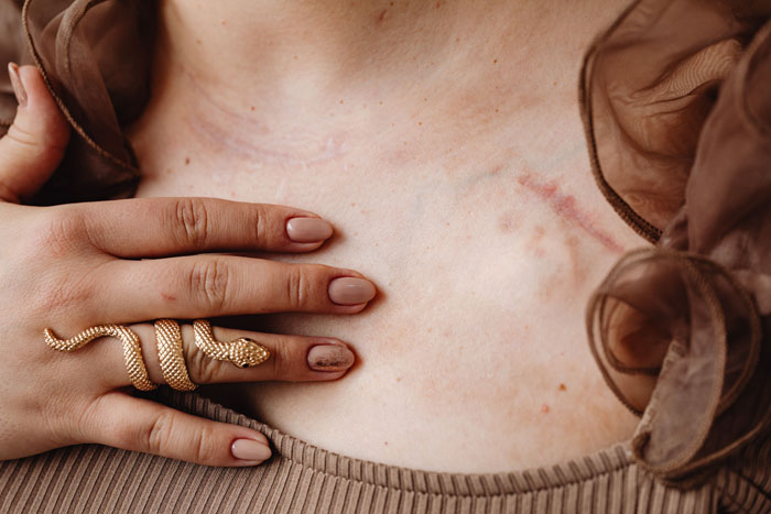 47 People Who Survived The Craziest And Most Terrifying Moments Of Their Lives