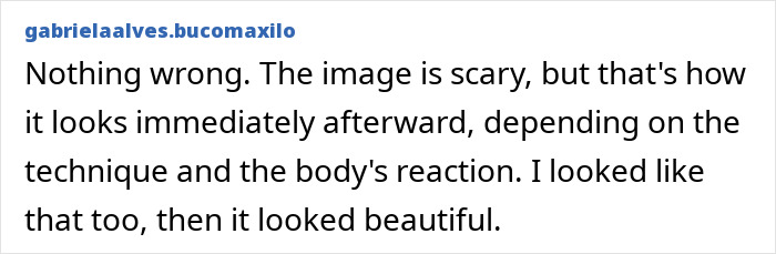 A comment on a woman's dramatic cosmetic procedure face change explaining initial swelling and eventual beauty. A comment on a woman's dramatic cosmetic procedure face change explaining initial swelling and eventual beauty.