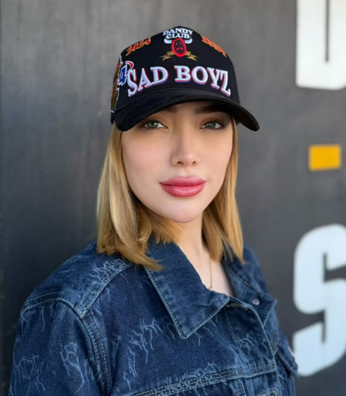 A beauty influencer after a cosmetic surgery procedure, highlighting potential risks in private clinics. A beauty influencer after a cosmetic surgery procedure, highlighting potential risks in private clinics.