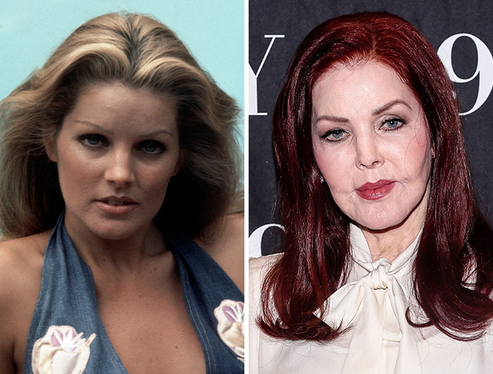 Priscilla Presley's pre-plastic surgery photos compared to her appearance post-surgeries, revealing significant changes.
