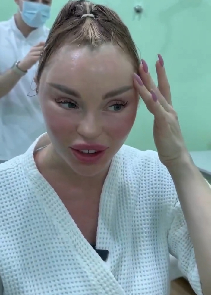 Woman’s Post-Plastic Surgery Photos Divide The Internet As She And Her Surgeon Celebrate The Results