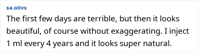 A social media comment detailing a positive experience with cosmetic procedures, resulting in a natural look. A social media comment detailing a positive experience with cosmetic procedures, resulting in a natural look.