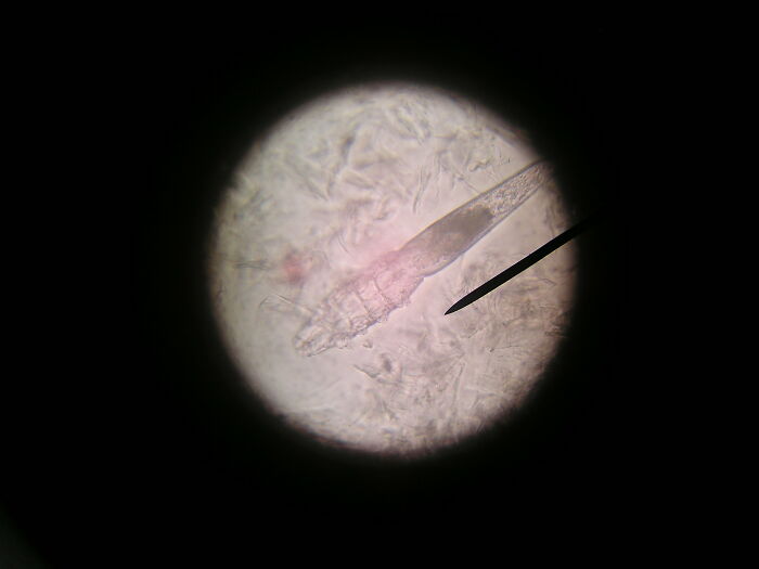 A microscopic view of a disturbing mite, a fact that changes the way people see the world.