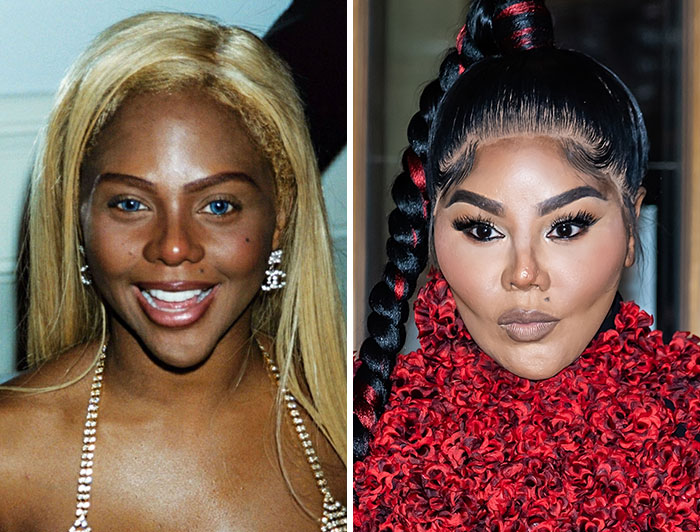 Lil Kim's before and after plastic surgery transformation, highlighting changes in her facial features and style.