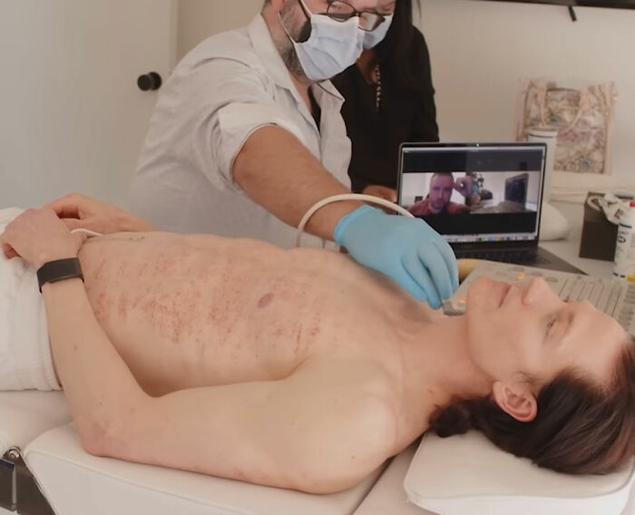 Biohacker Bryan Johnson undergoes a health check-up, revealing dreadful diagnosis despite his health regimen. Biohacker Bryan Johnson undergoes a health check-up, revealing dreadful diagnosis despite his health regimen.