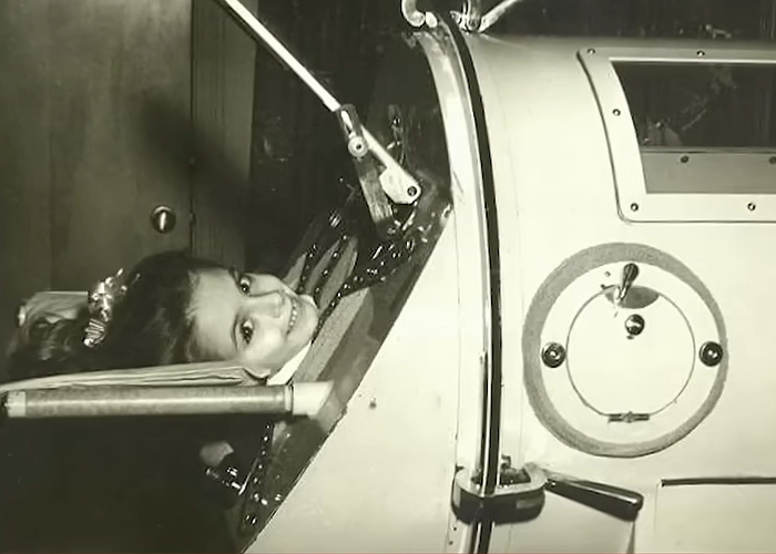 A young polio survivor woman smiles from inside an iron lung machine, her head resting on a pillow.