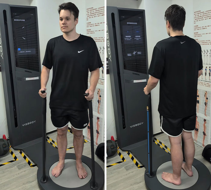 Man before-and-after attending Chinese fat camp. Man getting his body measured for his weight loss journey. Man before-and-after attending Chinese fat camp. Man getting his body measured for his weight loss journey.
