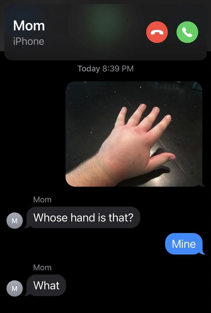 Funny posts about being a woman: a text message conversation about a swollen hand.