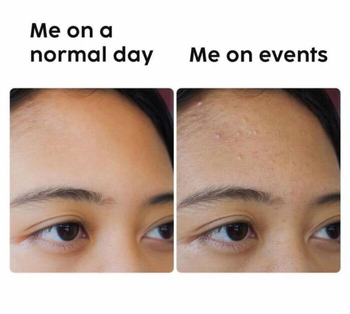 Funny posts about being a woman: A split image showing a woman's forehead, clear on a normal day vs. breakouts for events.