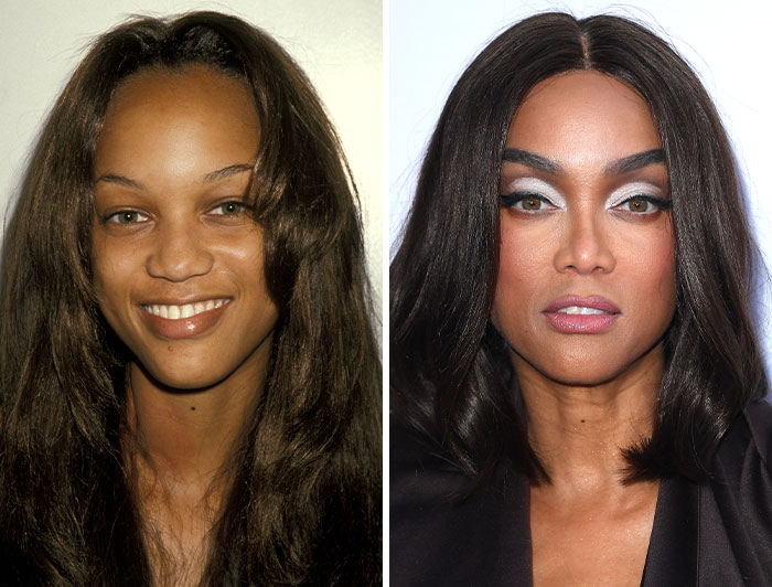 Tyra Banks pre-plastic surgery and post-plastic surgery comparison photos of celebrities.