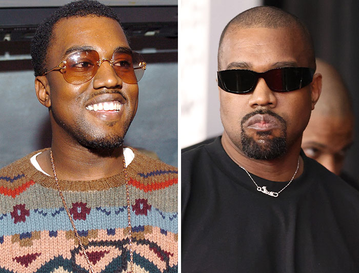 Kanye West, a star with an autism diagnosis, shown in a before and after comparison.
