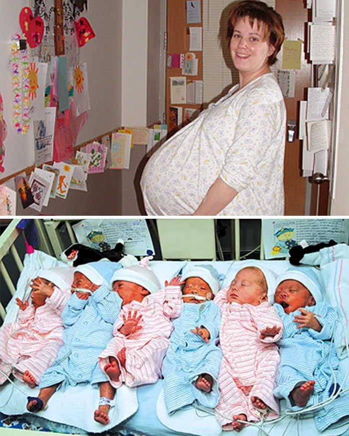 A split image of Collin Gosselin's mom pregnant, and newborns, as public battle intensifies.