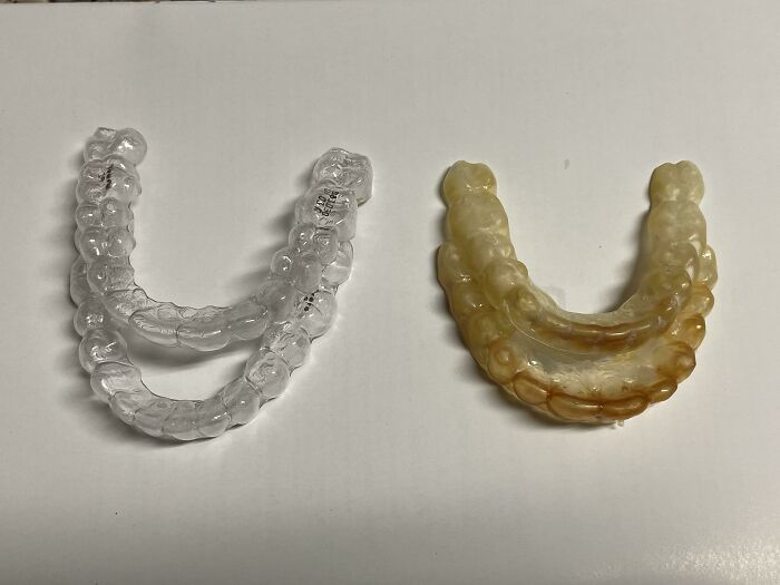 Before and after photo of two dental retainers; one is clear and new, the other is discolored and old, showing interesting changes.