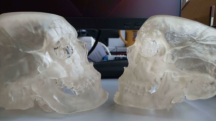 Before-and-after photos comparing two translucent skull models facing each other, highlighting changes in detail.