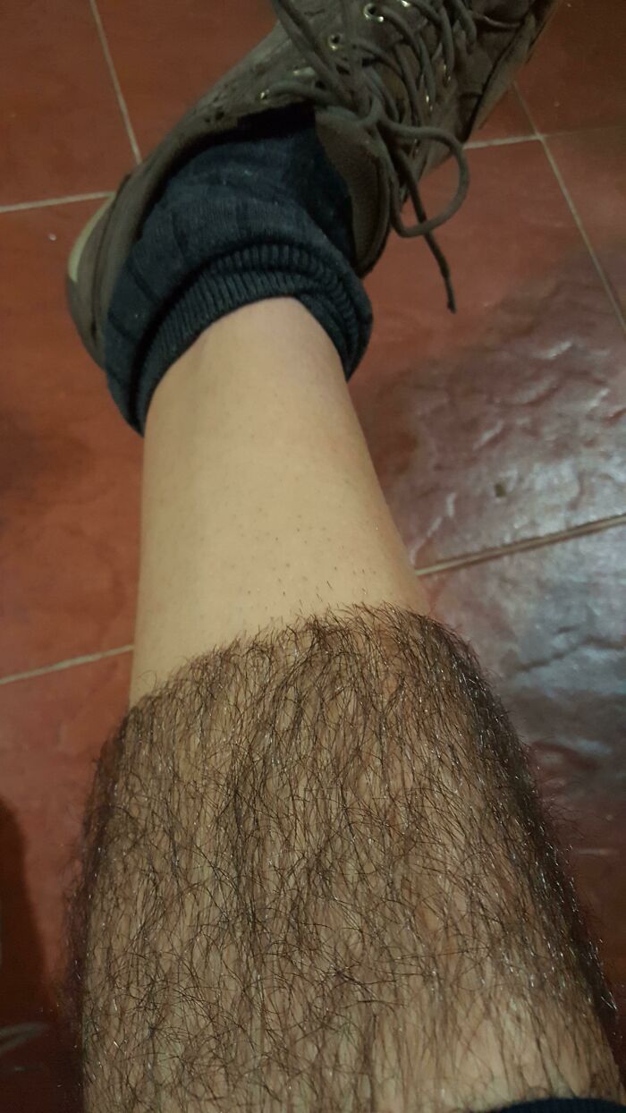 Leg with an interesting before-and-after photo of hair growth, showing a distinct change.