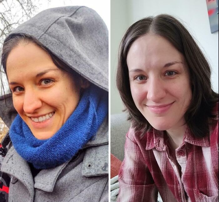 Before and after photo of a smiling woman showing how much things can change in appearance.