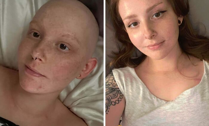 Before and after photo of a young woman showing the effects of her brain boost journey.