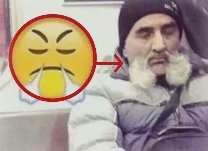 A man with a funny hairstyle that looks like an angry emoji is a bad hair mistake.
