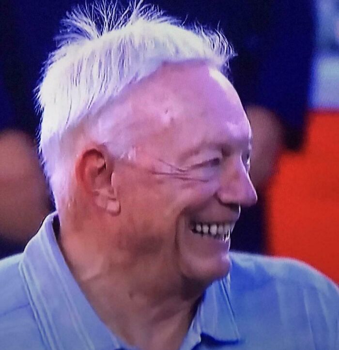 A smiling man with very short, spiky white hair on top and longer, thin hair on the sides, a bad hair mistake.