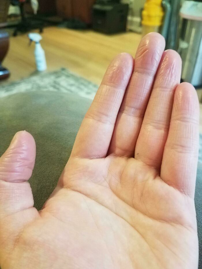 A hand with extremely wrinkled fingers and thumb, showcasing the strange human body.