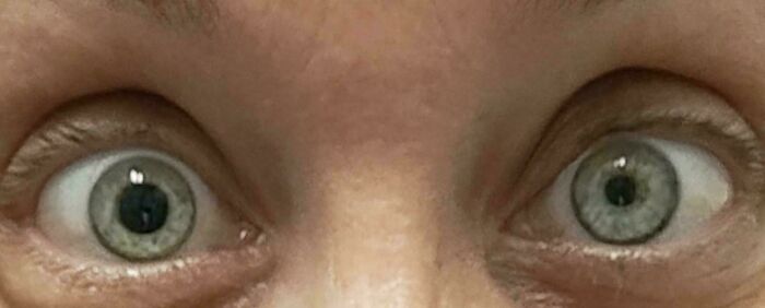Close-up of human eyes, wide open, showcasing the strange and amazing human body.