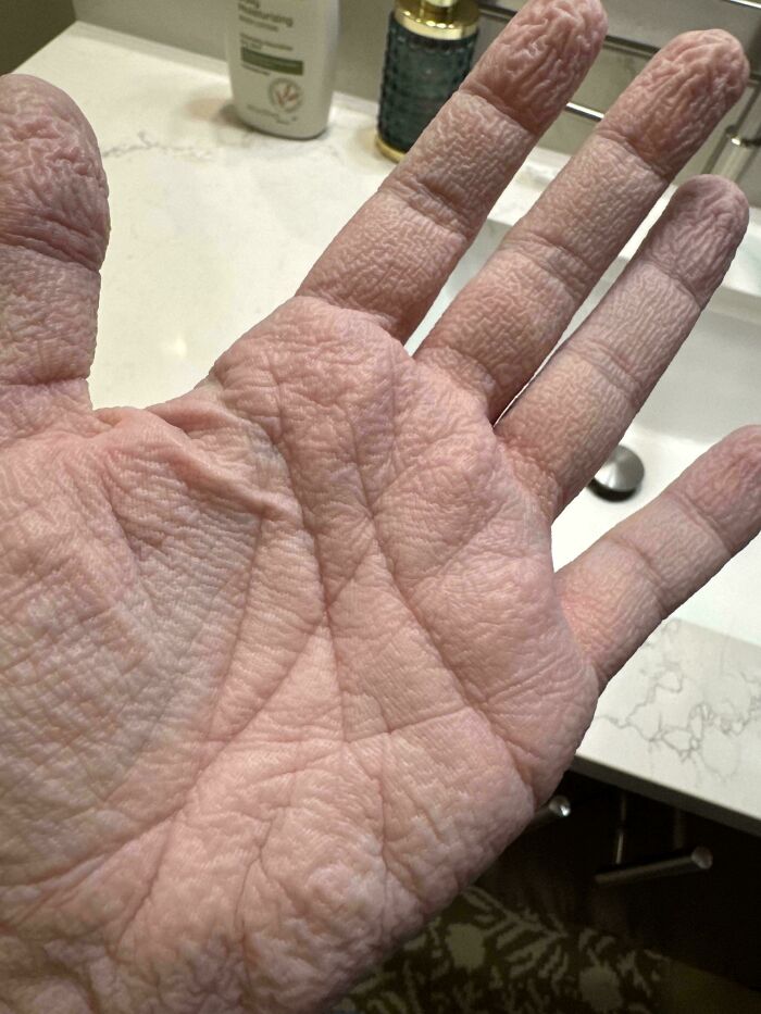 A human hand with deeply wrinkled skin, showing the strange and amazing human body after prolonged water exposure.
