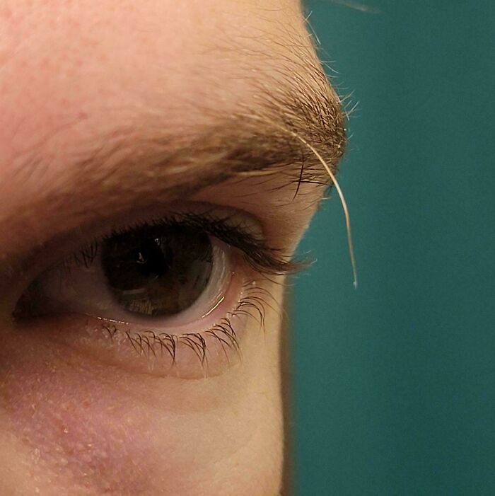 A close-up of a human body eye with a very long, single white eyelash growing from the eyebrow, a strange and amazing feature.