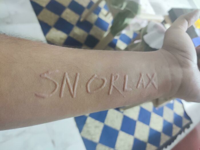 An arm with the word SNORLAX visibly raised on the skin, illustrating the strange and amazing human body.