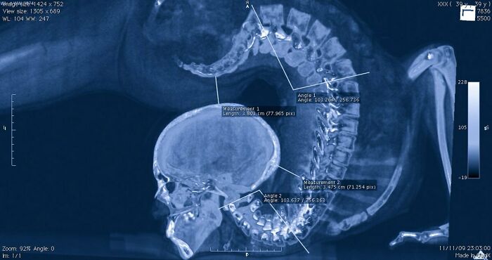 A medical scan of the human body's head and spine, illustrating the strange and amazing human body.