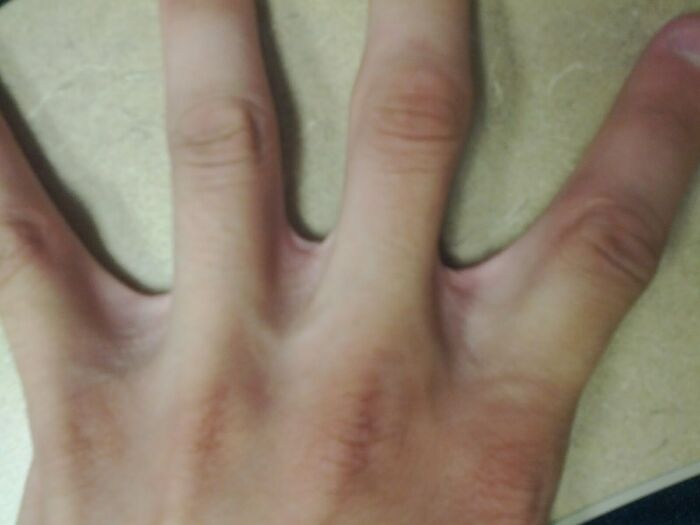 A close-up of a human hand with abnormally long and slender fingers, showcasing the strange human body.