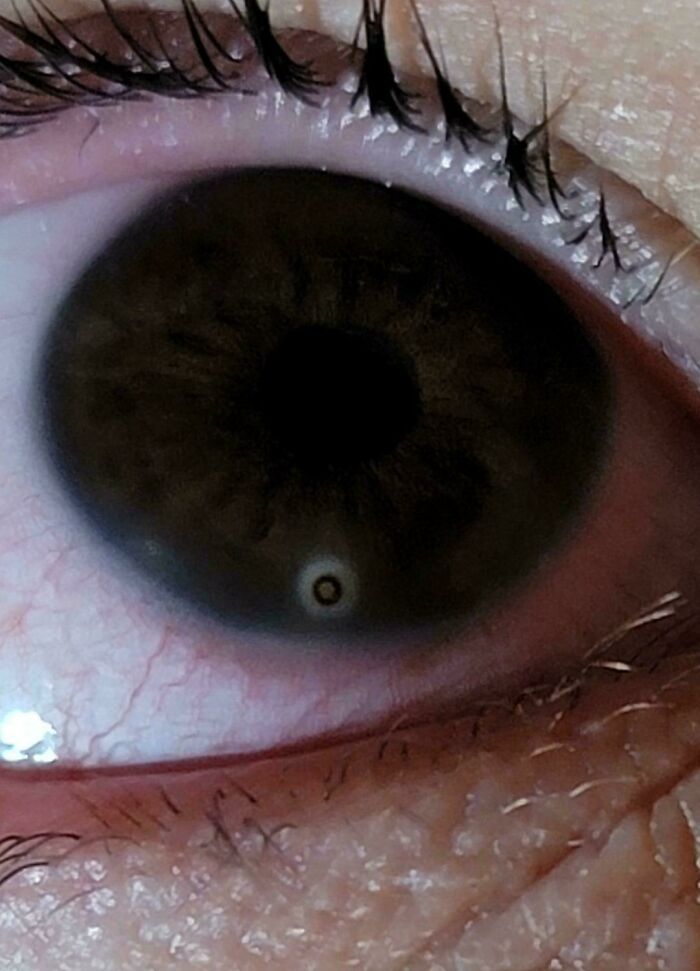A close-up of an eye with a perfectly circular white reflection in the iris, highlighting the strange human body.