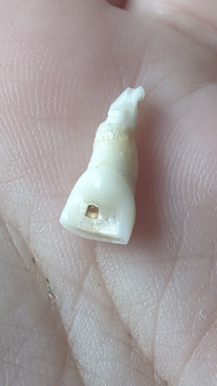 A small, extracted human body tooth, showing its root and a cavity, held on a person's palm, highlighting its strange details.