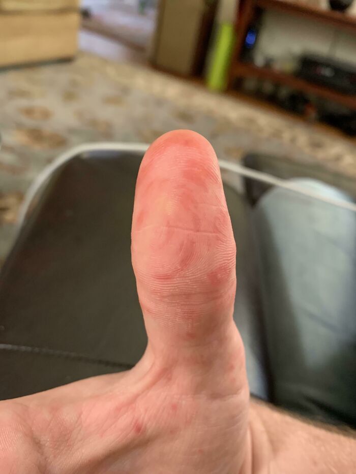 A person's thumb with a distinct pattern, exemplifying the strange and amazing human body.