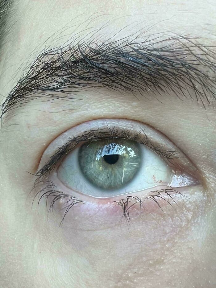 A close-up of a human eye with unique light green irises, illustrating the strange and amazing human body.
