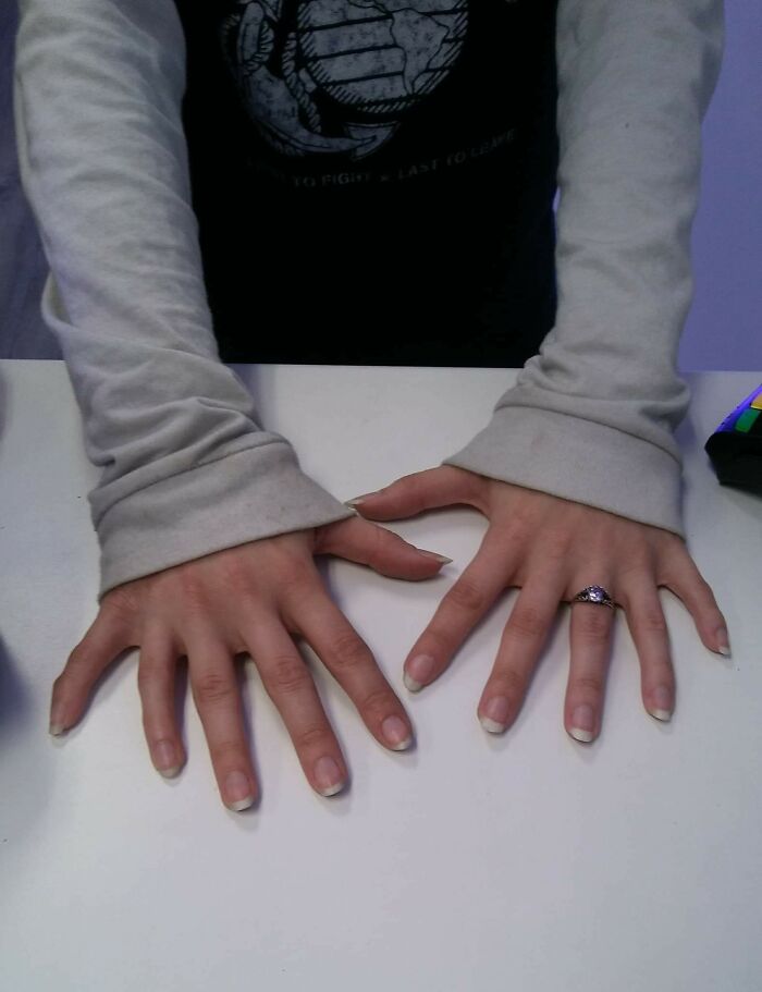 A pair of hands with hypermobile fingers, showcasing the strange and amazing human body.