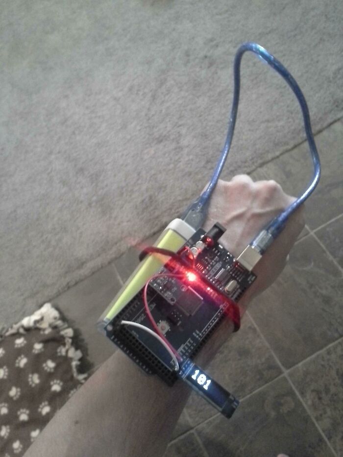 An arm wearing a complex electronic device with wires and a glowing light, strapped on as an unhinged way to fix something.