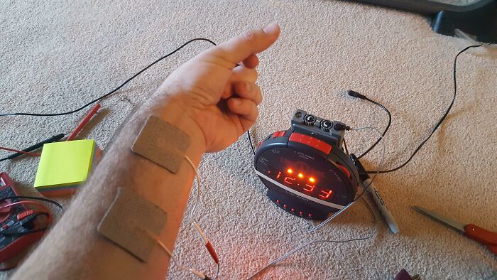 A person with electrode pads on their arm connected to wires and a digital clock, an unhinged way to fix something.