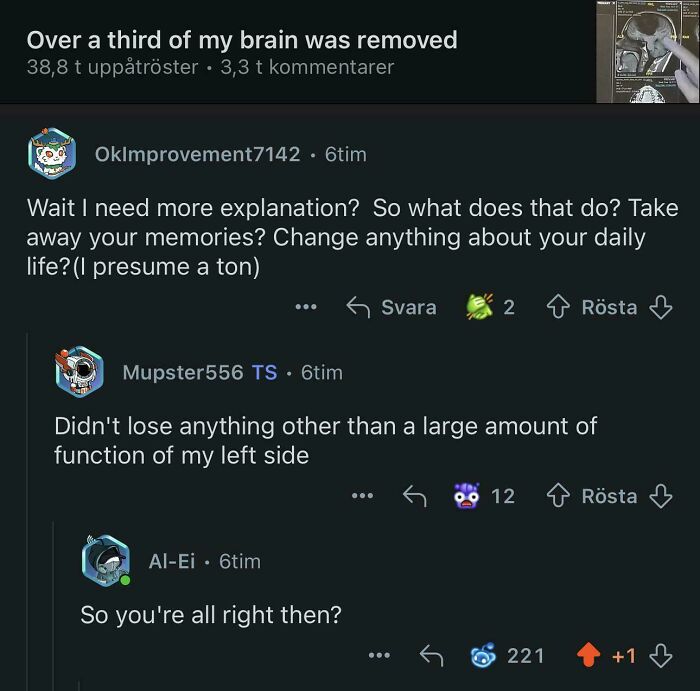 A screenshot showing funny comments on Reddit about a user who had part of their brain removed. This is one of many funny and savage examples.
