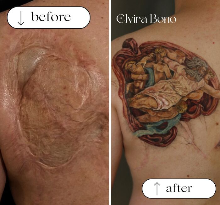 Detail Of Tattoo In Deep Scar On The Back By Accident