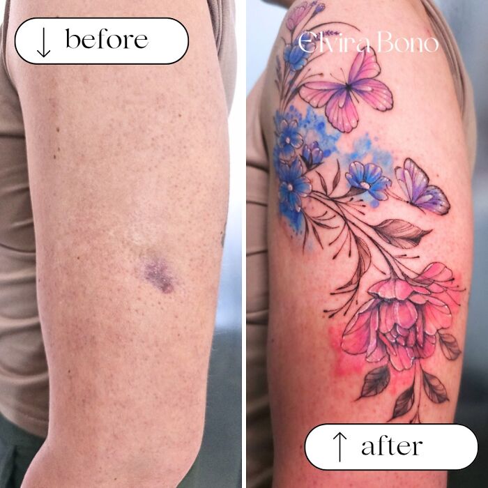 Tattoo In A Domestic Accident Scar