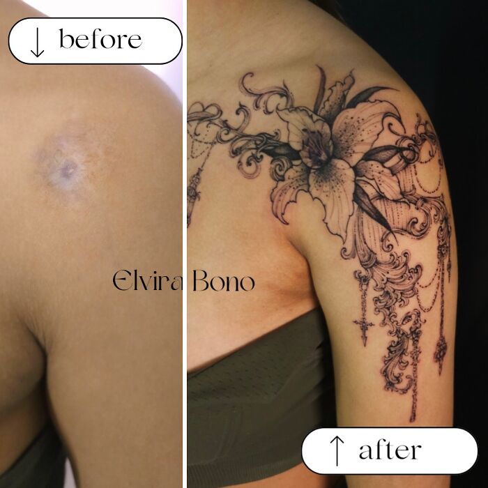 Scar Tattoo By Bicycle Accident