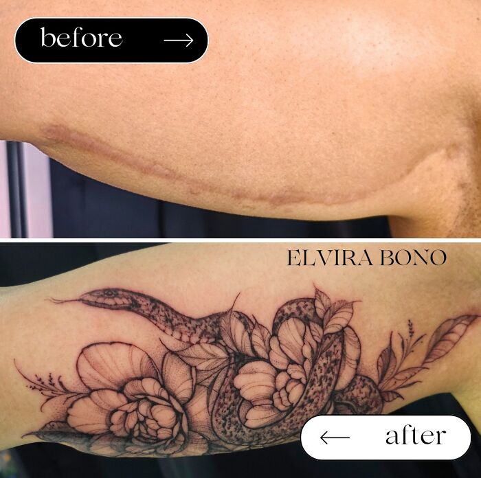 Brachioplasty Scar Tattoo After Weight Loss