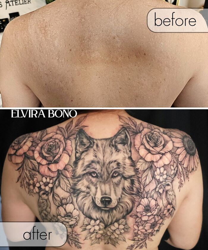Tattoo On Acne Scars