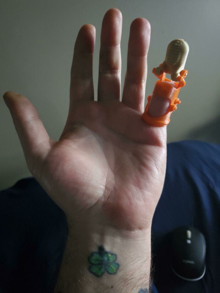 Amazing 3D printing creation: an orange and tan finger splint on a hand with a four-leaf clover tattoo.