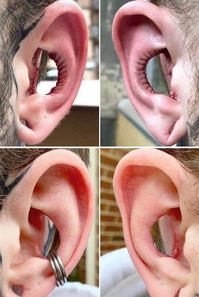 Four images of extreme earlobe stretching with a large hole, a ridiculous body modification.