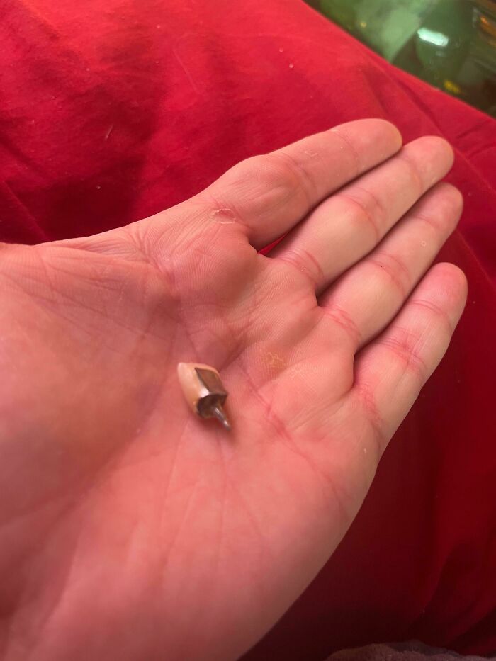A person's hand holding a broken tooth, signifying a bad day.