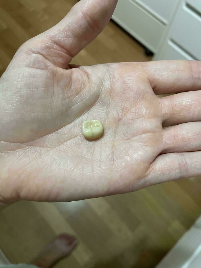 Empecé el fin de semana arrancándome la corona mientras usaba hilo dental.